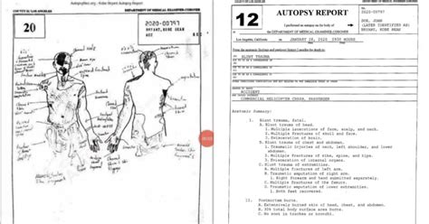 gigis autopsy report|Gigi Autopsy Report PDF: Analysis of Gigi Autopsy。